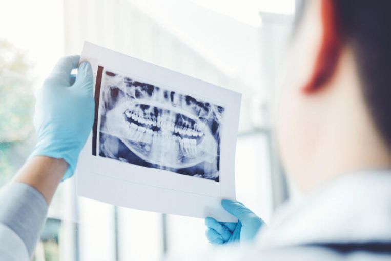 Grieta bajo presión: los dentistas ven más casos de dientes dañados en la pandemia