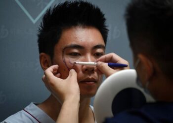 Los hombres en China pasan por el quirófano para aumentar sus oportunidades de vida